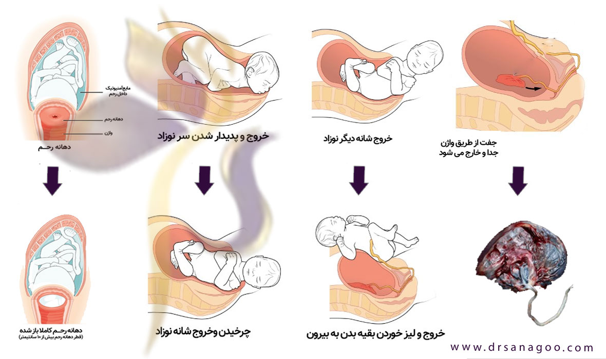 زایمان طبیعی + فیلم بدون سانسور دکتر الهه ثناگو