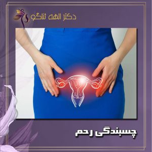 چسبندگی رحم - دکتر الهه ثناگو