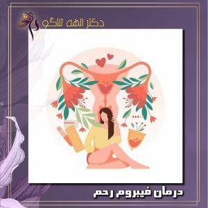درمان فیبروم رحم - دکتر ثناگو
