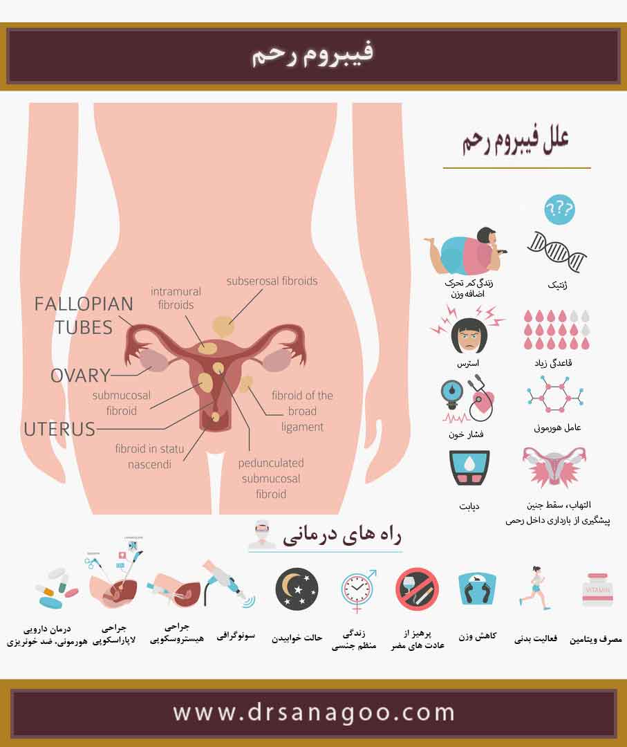 آناتومی رحم و علت ایجاد فیبروم رحم - دکتر ثناگو