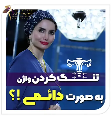 عمل تنگ کردن واژن دائمی در تهران - دکتر ثناگو
