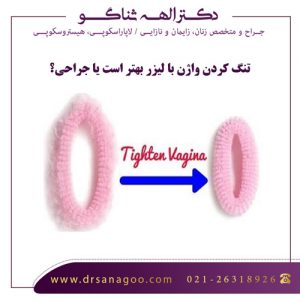 تنگ کردن واژن با لیزر بهتر است یا جراحی؟ - دکتر ثناگو