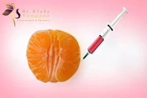 تزریق چربی به واژن عکس - دکتر ثناگو