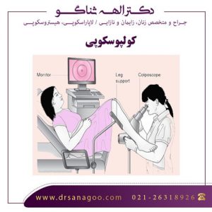 کولپوسکوپی در تهران - دکتر ثناگو