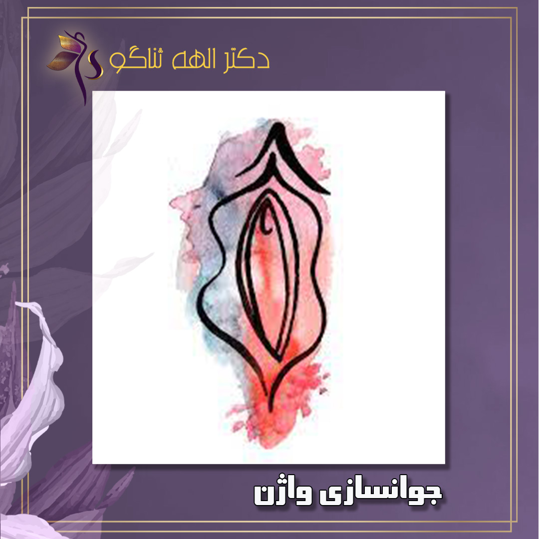 جوانسازی واژن