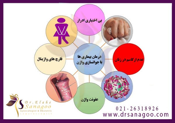 درمان-بیماری-های-با-جوانسازی-واژن