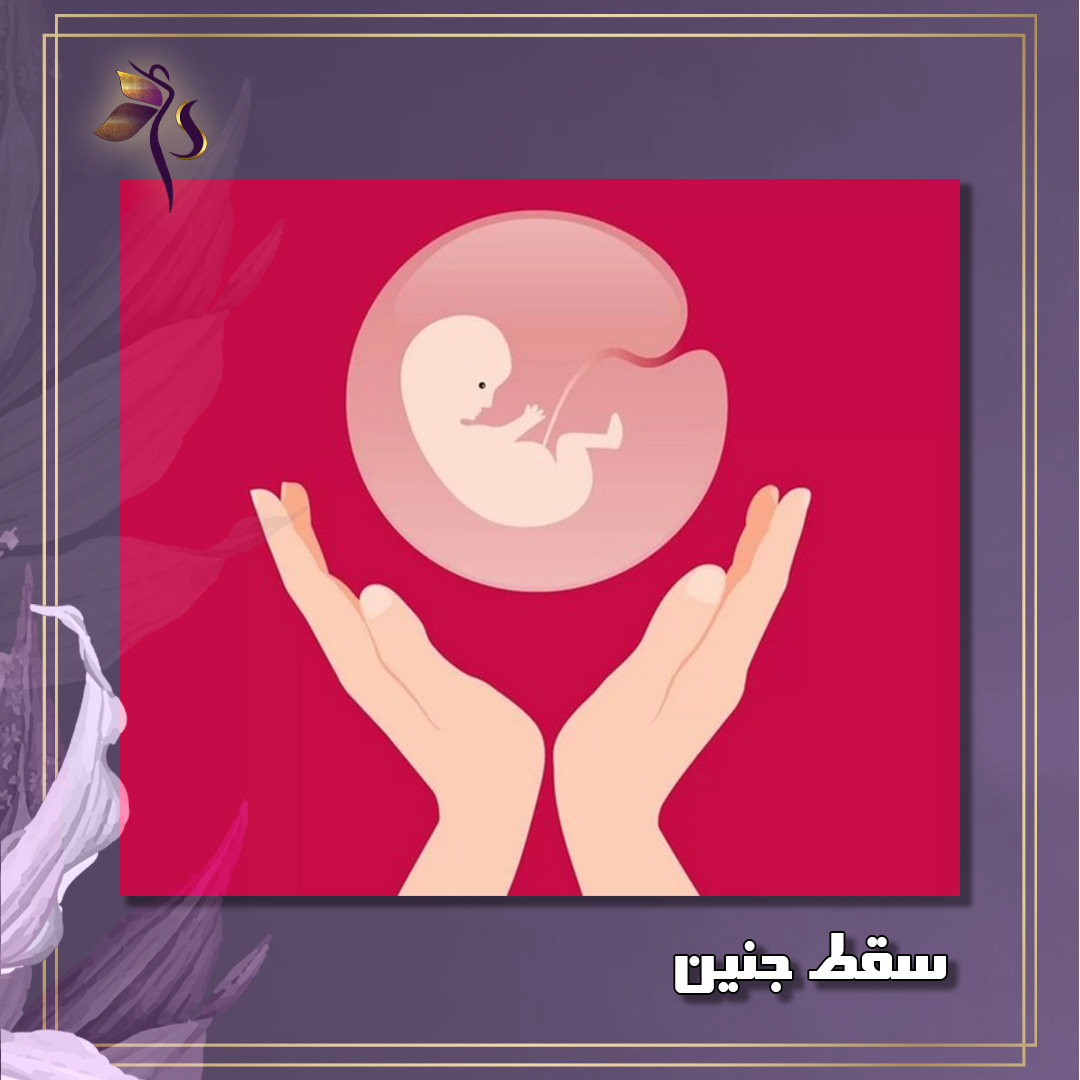 سقط جنین