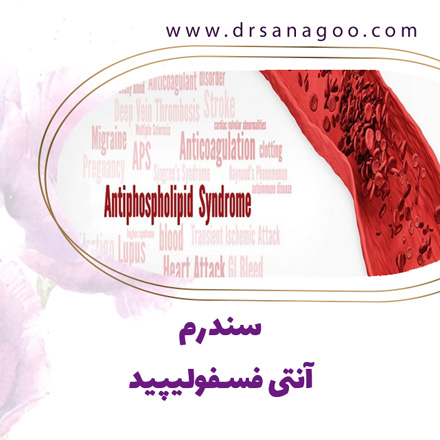 سقط جنین - دکتر ثناگو