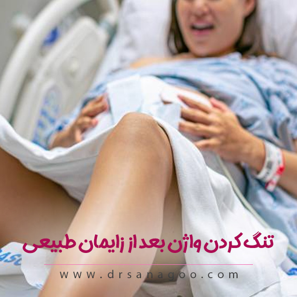 تنگ کردن واژن بعد از زایمان طبیعی