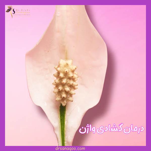 گشادی واژن چیست؟+ علائم و علت گشادی