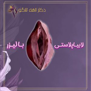 لابیاپلاستی با لیزر - دکتر الهه ثناگو