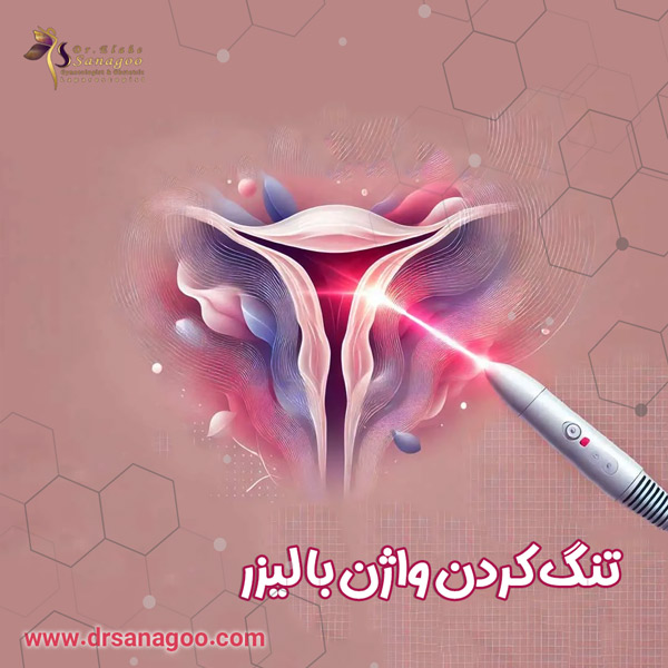 تنگ کردن واژن با لیزر در تهران + دکتر الهه ثناگو