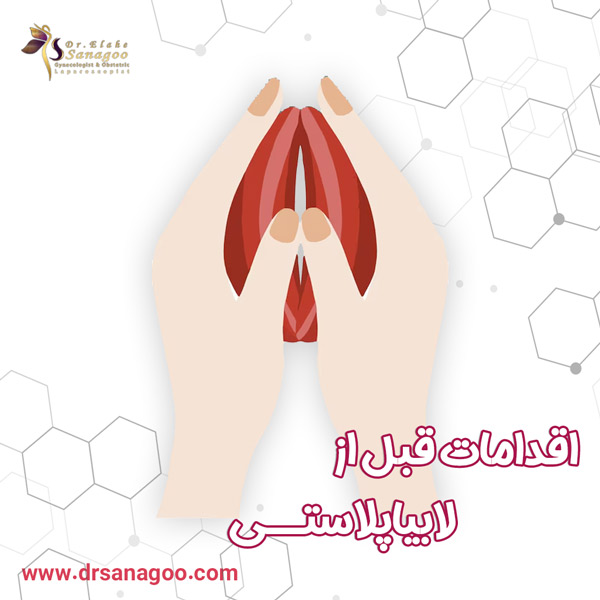 اقدامات قبل از لابیاپلاستی شامل چه مواردی است؟