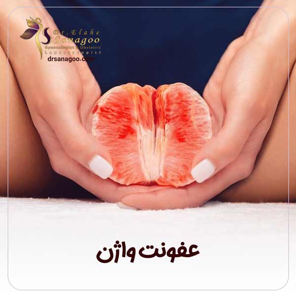 علائم و نشانه های عفونت واژن