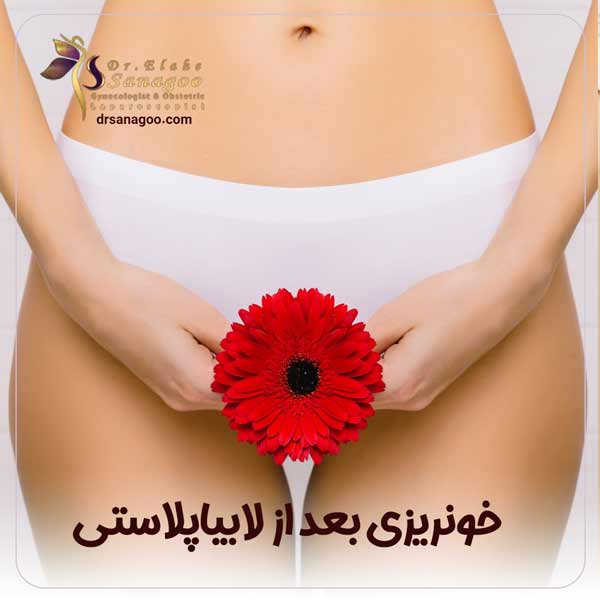 راه های کنترل خونریزی بعد از لابیاپلاستی