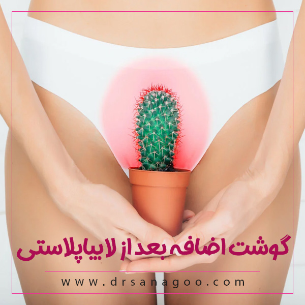گوشت اضافه بعد از لابیاپلاستی آیا درمان می شود ؟