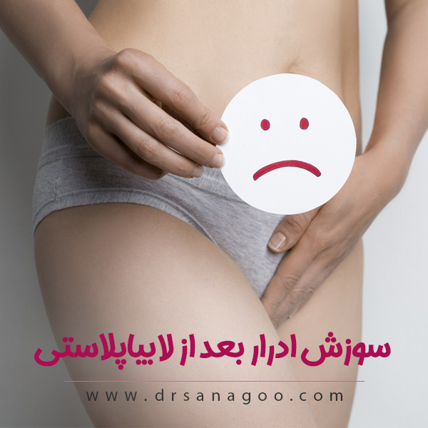 سوزش ادرار بعد از لابیاپلاستی