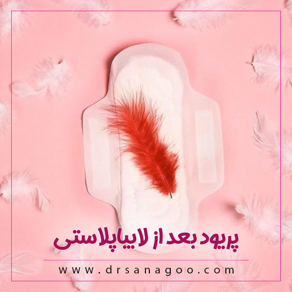 پریود بعد از لابیاپلاستی + دکتر الهه ثناگو